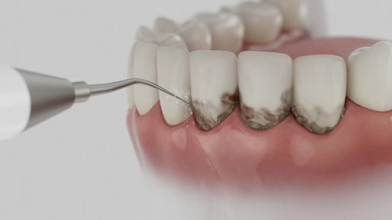Reliable Tooth Extraction contractor in Oak Harbor, OH by Smile Center Dentistry